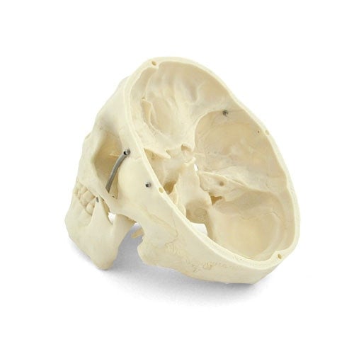 Human Skull Model