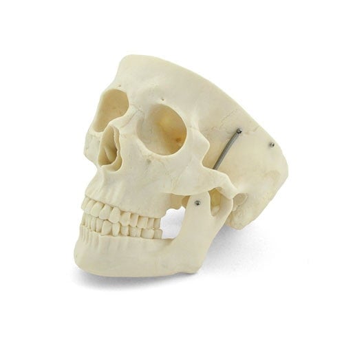 Human Skull Model