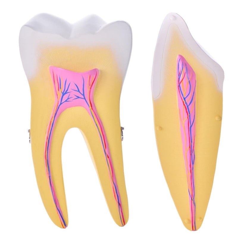 Dismountable Tooth Models, Set of 3