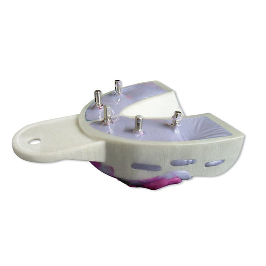 Miratray Implant Upper Jaw, S1 small